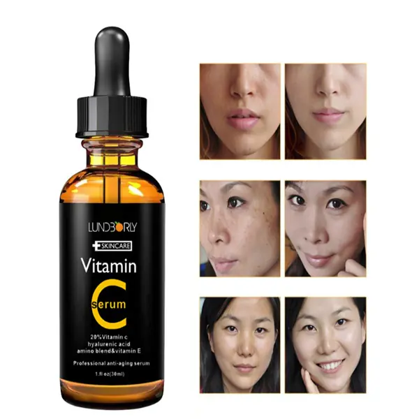Vitamin C and Vitamin E Skin Care Formula Vitamin C and Vitamin E skin care formula 30ml